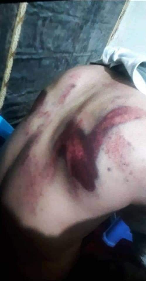 ضربو شتم و محکمهی صحرایی یک پزشک توسط طالبان در بدخشان ـ مجلهی اورال ضربو شتم و محکمهی صحرایی یک پزشک توسط طالبان در بدخشان ـ مجلهی اورال